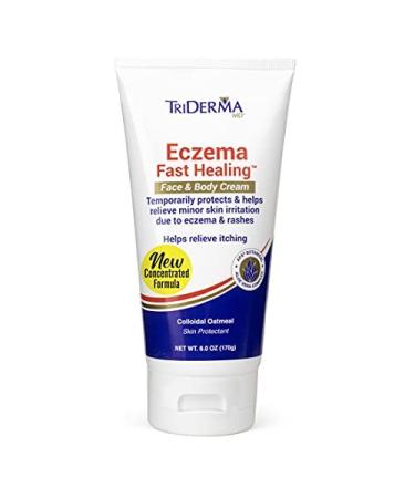 TriDerma Eczema Cream Fast Healing Eczema Relief for Face and Body 6.0 Ounce Tube