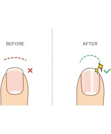 Foot File Callus Remover - Foot Care Pedicure Tool Nail File - Glass Pedicure Tool Foot Scraper Pedicure Foot Buffer for Cracked Heels & Dry Skin - Buy Online on GoSupps.com