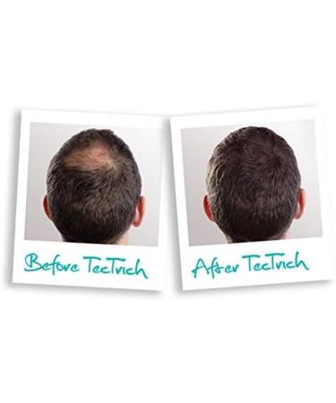 Hair Building Fibres for Thinning Hair (Auburn) - Buy Online on GoSupps.com