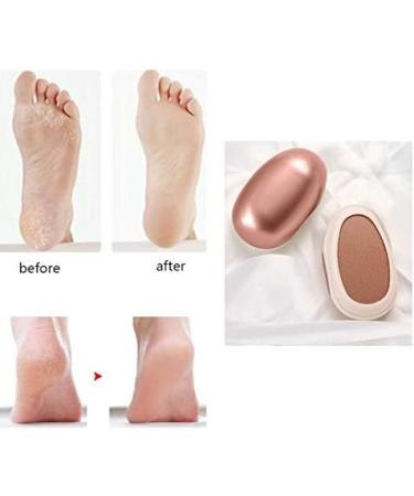 IKAAR Foot File Foot Pedicure Tool Foot File Dead Skin Remover Foot Care Pedicure Tool for Cracked Feet Make Foot Beauty and Extra Smooth (Rose Gold) - Buy Online on GoSupps.com