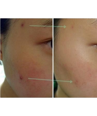 Sidmool Skin Barrier Care Spot Cream | Rapid Cooling for Dark Blemishes - Buy Online on GoSupps.com