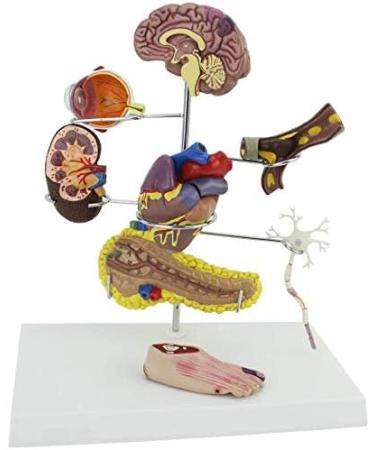 Model Model of Diabetes Complications Heart Pancreas Brain Neuron Model Foot Medical Communication Aids for The Diabetes Demonstration - Buy Online on GoSupps.com
