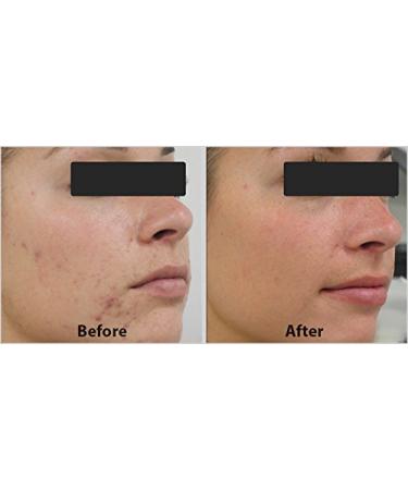 DNA Code - 20% Glycolic Acid Cell Renewal Peel w/Retinol CoQ10 Hyaluronic Acid M3000 2 Count (Pack of 1) - Buy Online on GoSupps.com