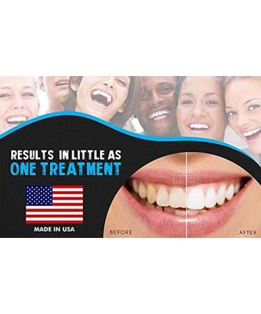 Professional 44% Carbamide Peroxide Teeth Whitening Kit with Gel, Trays, and LED Light - Buy Online on GoSupps.com