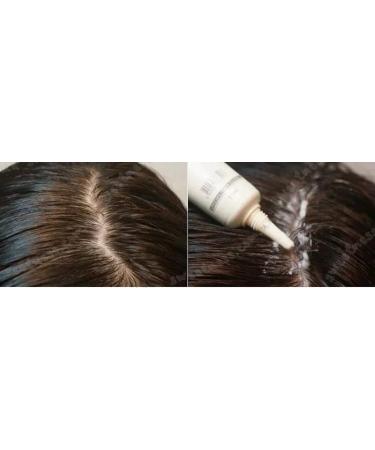 Lador Scalp Scaling Spa Hair Treatment (15g x 4) - Deep Cleaning Conditioner for Healthy Scalp Reduces Excess Oil & Dandruff - Buy Online on GoSupps.com