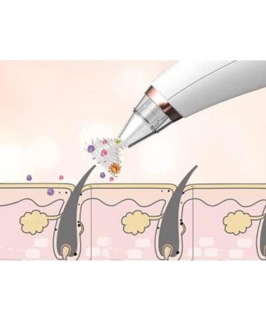 PARENCE Electric Blackhead Vacuum Cleaner | 3 Replaceable Tips | Pore Cleansing & Blackhead Extractor - Buy Online on GoSupps.com