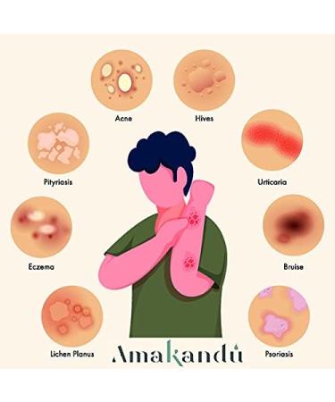 Repairing Balm with Hyaluronic Acid - Acne Treatment - Moisturizes Repairs Skin - Peeling Itching Redness - 100ml - Amakandu - Made in Spain - Buy Online on GoSupps.com