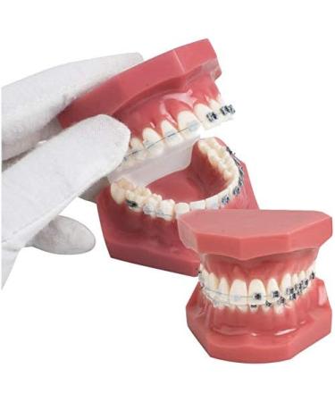 Orthodontic Teeth Model with Mental Brackets & Red Ligature - Tipodonto Dental Support for Treatment - Buy Online on GoSupps.com