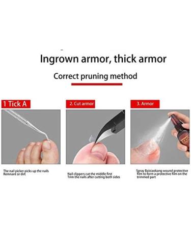 ISTOVO 4Pcs/Lot Paronychia Nail Tools Nail Clipper Nail Correction Thick Nails Ingrown Toenails Nippers Dirt Remover - Buy Online on GoSupps.com