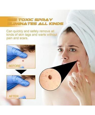 (100% Effective) Tag Recede Bee Venom Tag Recede Bee Venom Spray - Buy Online on GoSupps.com