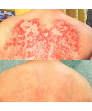 Buy Emulsion 2 - 15ML | Premium International Shipping | Best eCommerce Deals - Buy Online on GoSupps.com