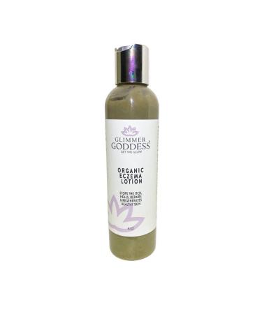 Glimmer Goddess Organic Eczema Lotion - Stop the Itch Heal The Skin