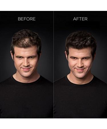 Toppik Hair Fibers Grande (27.5g) - Reddish | Buy Internationally for Thicker Hair - Buy Online on GoSupps.com