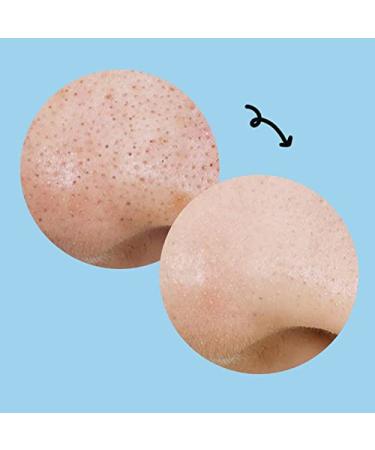 MANYO Blackhead Pure Cleansing Oil Kill Pad (50 Sheets) - Korean Facial Exfoliant for Blackheads and Enlarged Pores - Buy Online on GoSupps.com