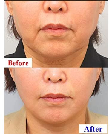 WhiteSilk Expert Drops SCM 30 + Retinaldehyde 0.1 Complex Ampoule for Wrinkles, Acne, Damage & Hydration - 0.68oz - Buy Online on GoSupps.com