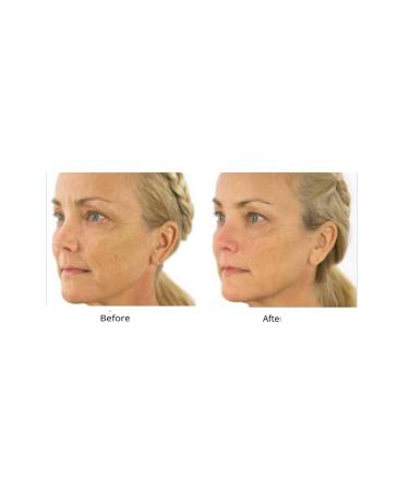 Dr. Sevinor s Combo Special 1oz.Facelift Solution Concentrated Serum Wakens Tired Looking Skin + Dr.Sevinor's Solution Gentle Exfoliating Cleanser Removes Make-up Residue Cleans Like No Other. - Buy Online on GoSupps.com