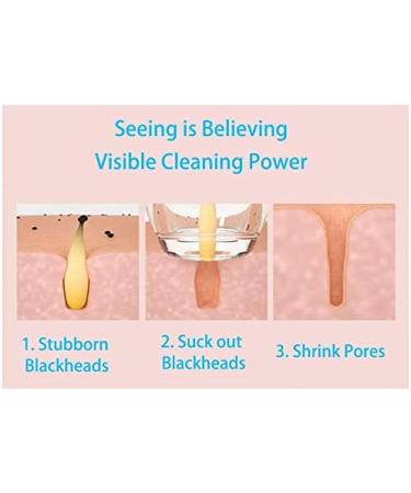 FEDRUI HD Visual Electric Blackhead Absorber USB Rechargeable Blackheads Suction Device 6 Gears Blackhead Remover with Microscope for Facial Deep Cleansing - Buy Online on GoSupps.com