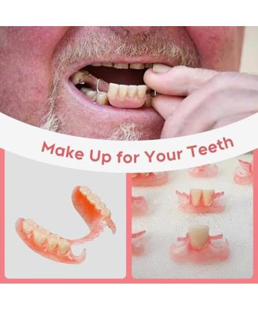 DIY Dentures Kit - Easy Repair for Missing Teeth | Full Set Temporary Fake Teeth - Buy Online on GoSupps.com