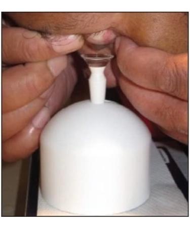 SynergEyes DMV Vented Scleral Cup Contact Lens Insertion Tool - Buy Online on GoSupps.com