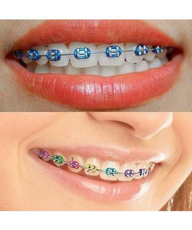 Orthodontic Ligature Ties for Brackets - Elastic O-Rings & Bands | 2080 Mixed Color Ties for Braces - International Shipping Available - Buy Online on GoSupps.com