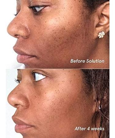 Buy Glossier Solution Exfoliating Skin Perfector 4.4 fl oz | International Shipping Available - Buy Online on GoSupps.com