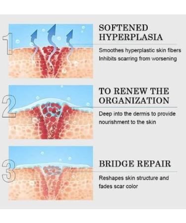 Advanced Scar Cream Gel | Medical-Grade Silicone for Keloid C-Section Acne Scars | Effective Scar Removal Treatment for Face & Body - 1 oz - Buy Online on GoSupps.com