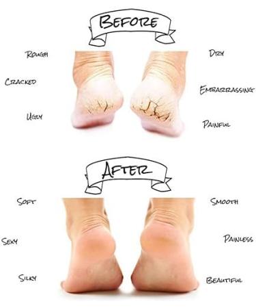Buy Xilinshop Spa Socks with Silicone Moisturizing Gel Inserts | Anti-Cracking & Anti-Slip Foot Care | 1 Pair - International Shipping - Buy Online on GoSupps.com