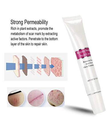 Scar Removal Cream | Anti-Scar Gel for Old Scars, Stretch Marks & Burned Skin Repair - Buy Online on GoSupps.com