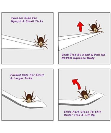 eTradewinds Tick-Off Pro Tool | Hygienic Stainless Steel Tick Remover 2-Pack - Buy Online on GoSupps.com
