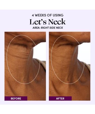 Menopause Cycle Kit: Coco Bliss Cream, Me.No.Pause Supplements, Let's Neck Serum - 3 Products Set - Buy Online on GoSupps.com