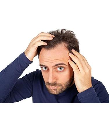DHT Blocker Hair Complex for Men & Women - Hair Growth Pills with Zinc - Supports Healthy Hair Growth - 60 Coated Tablets - Buy Online on GoSupps.com