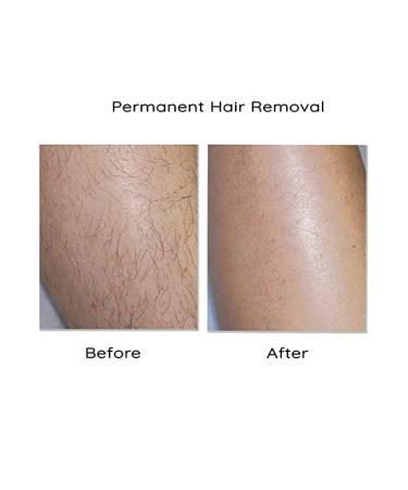 Metherb 30g Thanaka Powder & 30ml Kusumba Oil | Eco-friendly Hair Removal Set - Buy Online on GoSupps.com