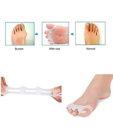 UNZYE Gel Toe Separator for Bunion Relief & Pain Alleviation - Men & Women - 1 Pair - Buy Online on GoSupps.com