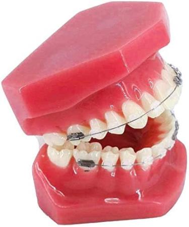 Orthodontic Dental Teeth Model with Metallic & Ceramic Brackets - Ideal for Dentist Patient Communication | Gylejwh - Buy Online on GoSupps.com