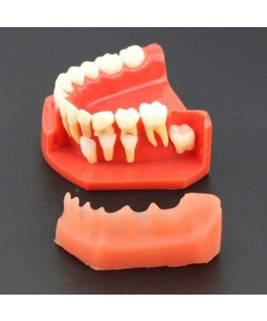 Buy Dental Study Teeth Model with Removable Gums & Permanent Teeth - Ideal for Demonstration & Education | International Shipping Available - Buy Online on GoSupps.com