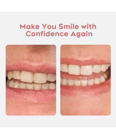 DIY Dentures Kit - Easy Repair for Missing Teeth | Full Set Temporary Fake Teeth - Buy Online on GoSupps.com
