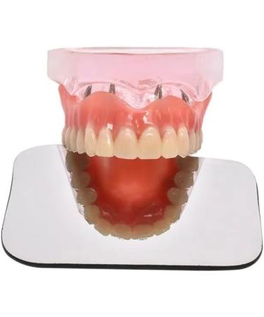 5 Piece Intraoral Mirror Set - Professional Orthodontic Photography | Dual-Sided Reflector for Clinical Dentists | High-Quality Dental Occlusal Mirrors - Buy Online on GoSupps.com