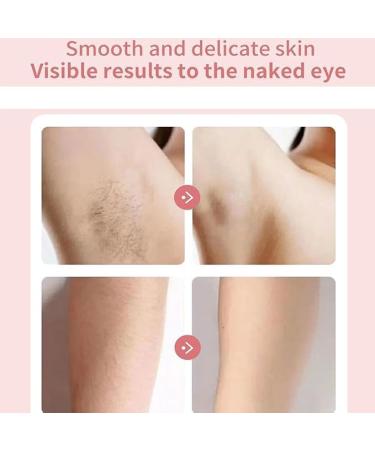 Skineo Shaver Pro Beauty Bloom Skineo Shaver Pro Dusk Razor For Women Bikini Legs Underarm Public Hairs Rechargeable Trimmer With Detachable Head Cordless Wet Dry Use (2pcs) - Buy Online on GoSupps.com