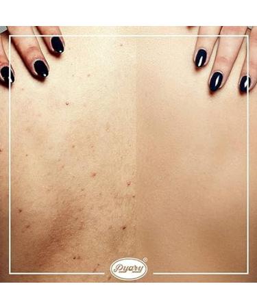 Turmeric Soap Bar - Illuminate Skin & Remove Dark Spots | 12-Pack Bliss | Naturally Crafted Ingredients - Buy Online on GoSupps.com