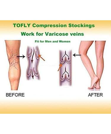 TOFLY Medical Compression Stockings 20-30 mmHg Knee High Socks - Open Toe Black - Size M - Buy Online on GoSupps.com