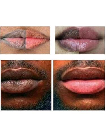 Lip Lightening for Dark Lips Lip Brightener for Smokers Dark Lip Treatment Lightening Cream for Pink Lips Lip Lightener for Smoker Lips Lip Lightening balm for Men and Women - Buy Online on GoSupps.com