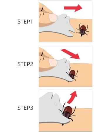 EHOTER Tick Card with Magnifying Glass 4 PCS Tick Cards Tick Card for People Children Dogs Cats Ideal for Outdoor Activities - Buy Online on GoSupps.com