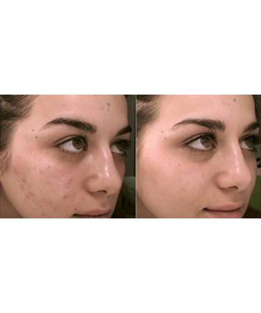 First Lady Original Skin Lightening Cream 50g - Fast Actives - with Macadamia Oil - Buy Online on GoSupps.com