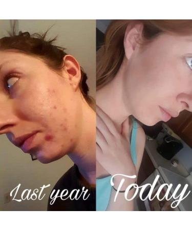 Ninja Face Cleanser for Women & Men Revolutionary Salicylic Acid Face Cleanser Sulphur and Paraben Free Restore PH Non-Irritating Ingredients 5.5 OZ - Buy Online on GoSupps.com