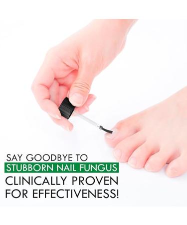 Viking Revolution Toenail Fungus Treatment - Extra Strength 1% Tolnaftate | Tea Tree Oil & Oregano Oil | Athletes Foot & Nail Fungus Remedy (0.5 Fl Oz - Buy Online on GoSupps.com