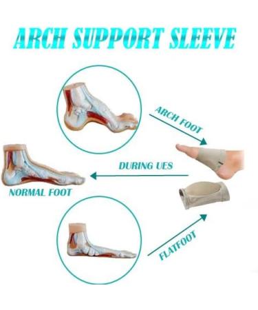 Soft Silicone Arch Support Sleeve - Foot Pain Relief for Flat, Fallen, High Arches - 1 Pair - Buy Online on GoSupps.com
