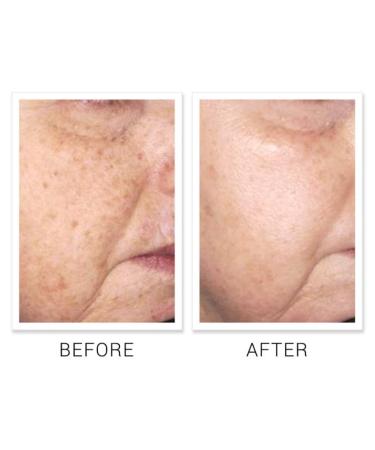 GLOBYME Skin - Brightening Pads with 2% Kojic Acid for Even Skin Tone & Discoloration Improvement - Non-HQ Formula - Buy Online on GoSupps.com