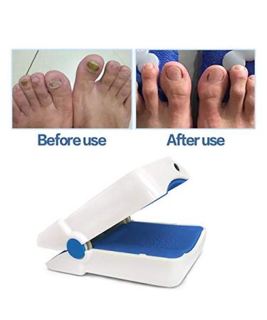 7-Minute Nail Fungus Cleaning Solution for Healthier and More Beautiful Fingernails and Toenails - Say Goodbye to Embarrassing Onychomycosis - Buy Online on GoSupps.com