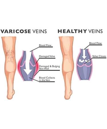 PACKO SOCKS Compression Socks 3 Pairs for Women & Men - Medical Nursing Hiking Recovery Travel & Flight - Black S/M - Buy Online on GoSupps.com