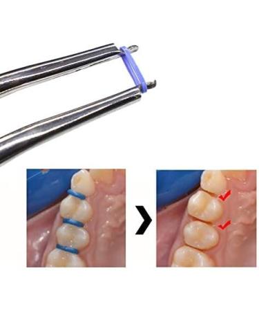 MIBICIRI 2000Pcs/2bags Dental Orthodontic Separator Ties Bulk Pack Elastic Band Force Continuous(Blue) - Buy Online on GoSupps.com